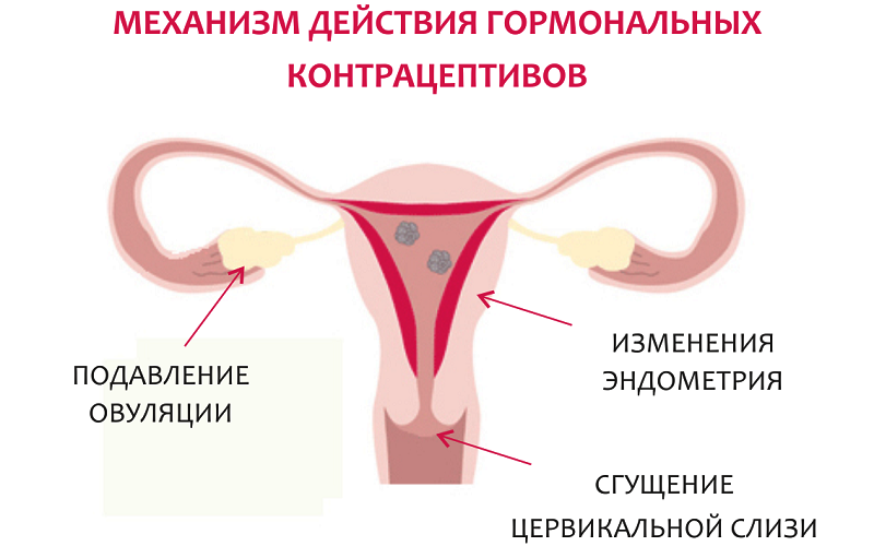 Действие гормональной контрацепции