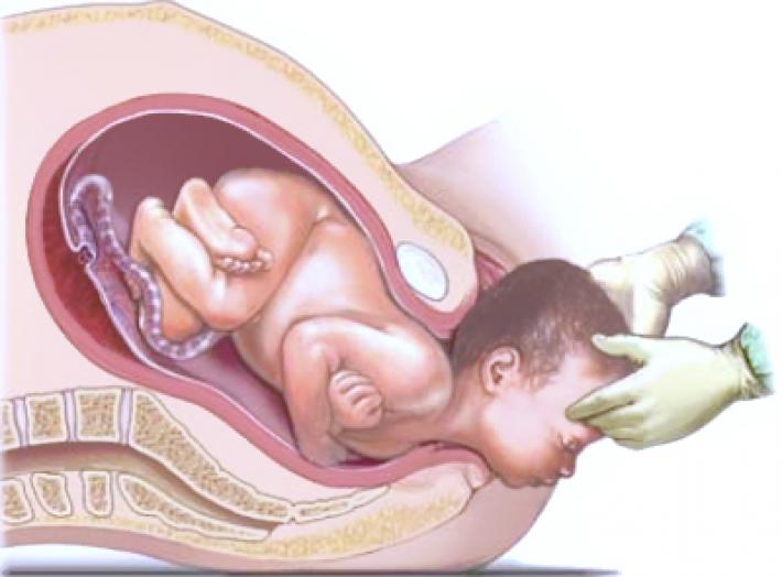 В процессе естественных родов организм ребенка крепнет и появляется на свет постепенно