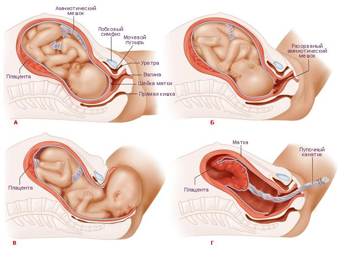 Процесс родов